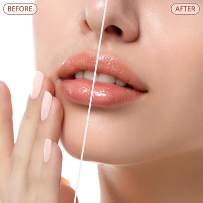Orignal Premium quality rechargeable Hair Removal Machine for Women – Painless Electric Facial & Body Hair Remover